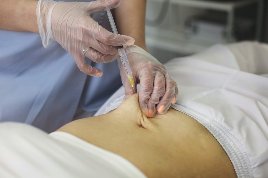 Belly injection of injection lipolysis, body shaping treatment