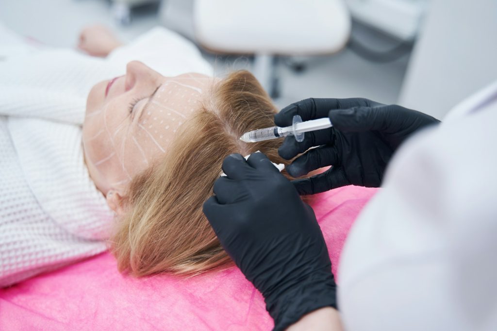 Woman receiving injection into scalp during mesotherapy treatment
